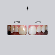 Essential Whitening Toothpaste